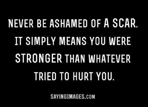 _1668117967.353807095-quote-about-a-scar-simply-means-youre-stronger-than-whatever-tried-o-hurt-you.png