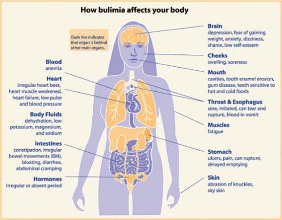 What are the consequences of  vomiting on a regular basis? 